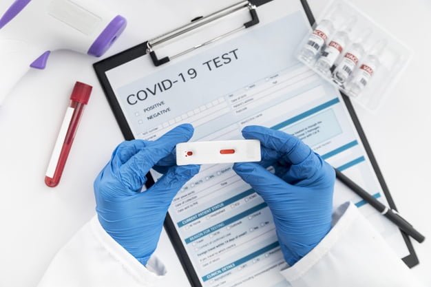 Ημερήσια έκθεση επιδημιολογικής επιτήρησης λοίμωξης από το νέο κορωνοϊό (COVID19) ISO WEEK 08  Δεδομένα έως 03 Μαρτίου 2021, ώρα 15:00